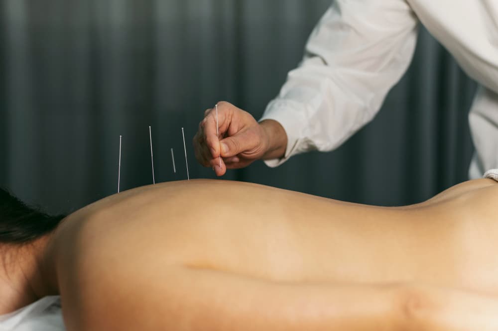 Needling Therapy